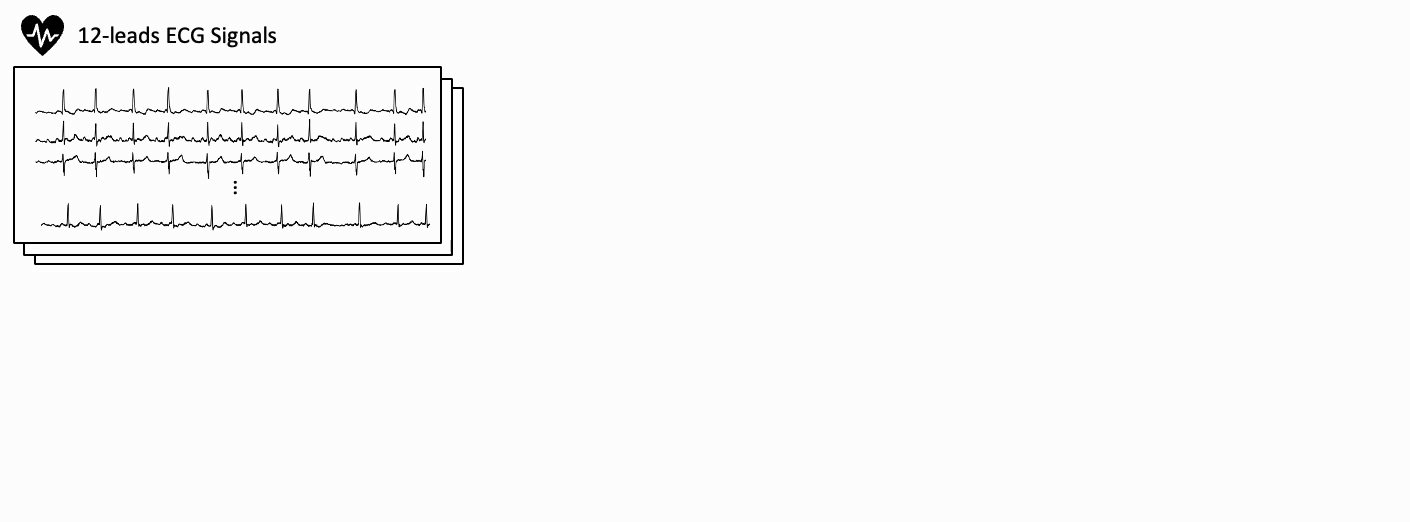 Illustration of our contrastive masked ECG-language modeling technique